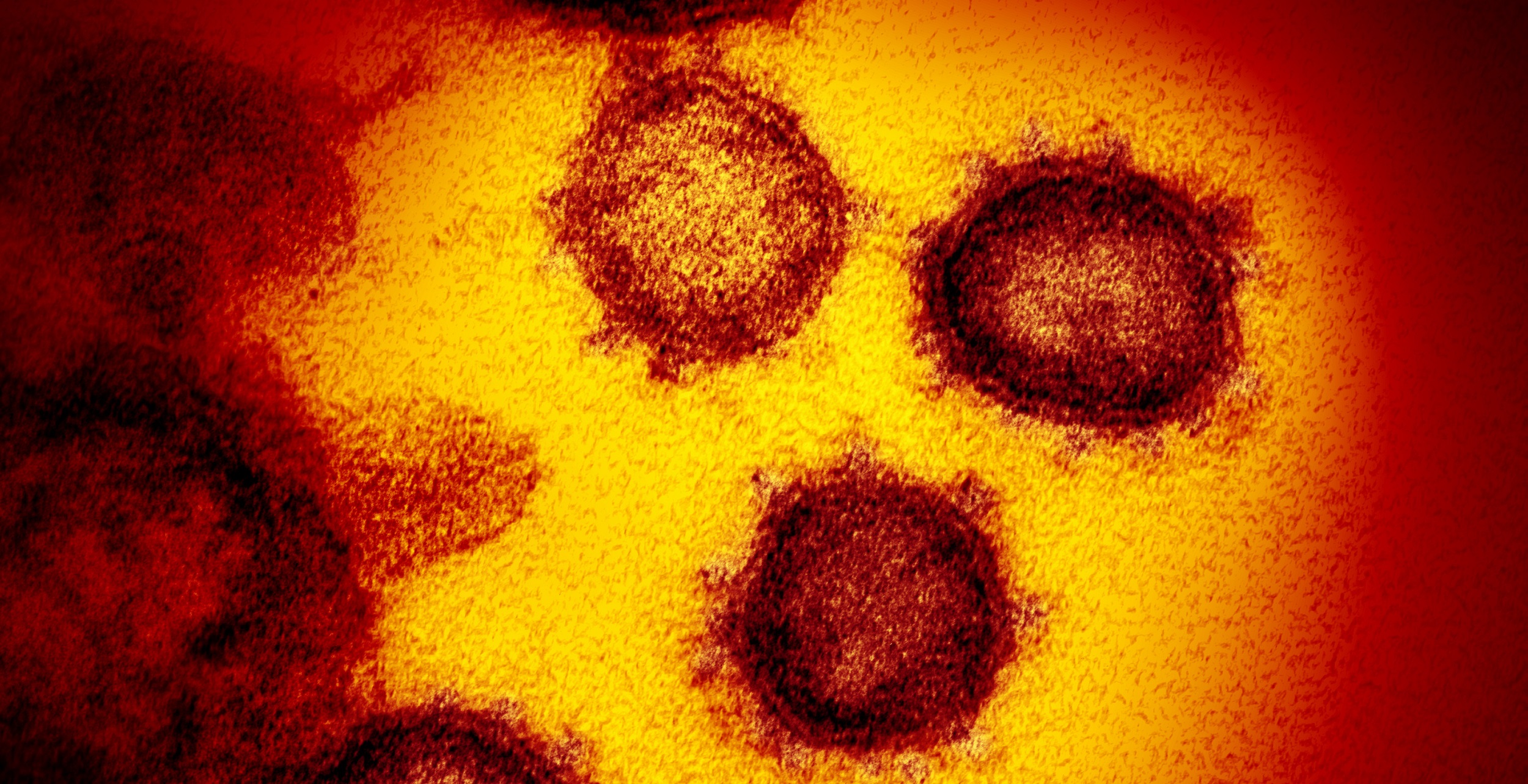 ¿Qué sabemos del coronavirus un año después de su descubrimiento?