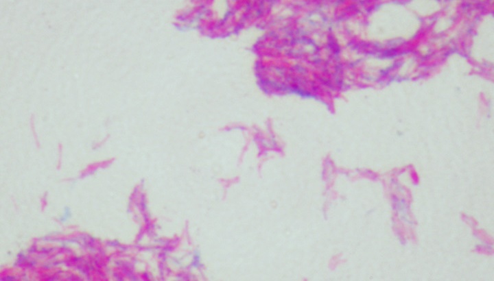 El ISCIII desarrolla un proyecto de investigación sobre tuberculosis zoonótica basado en el enfoque One Health