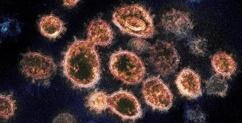 Hallan mutaciones que pueden reducir la inmunidad celular en subpoblaciones minoritarias ante una infección primaria por SARS-CoV-2