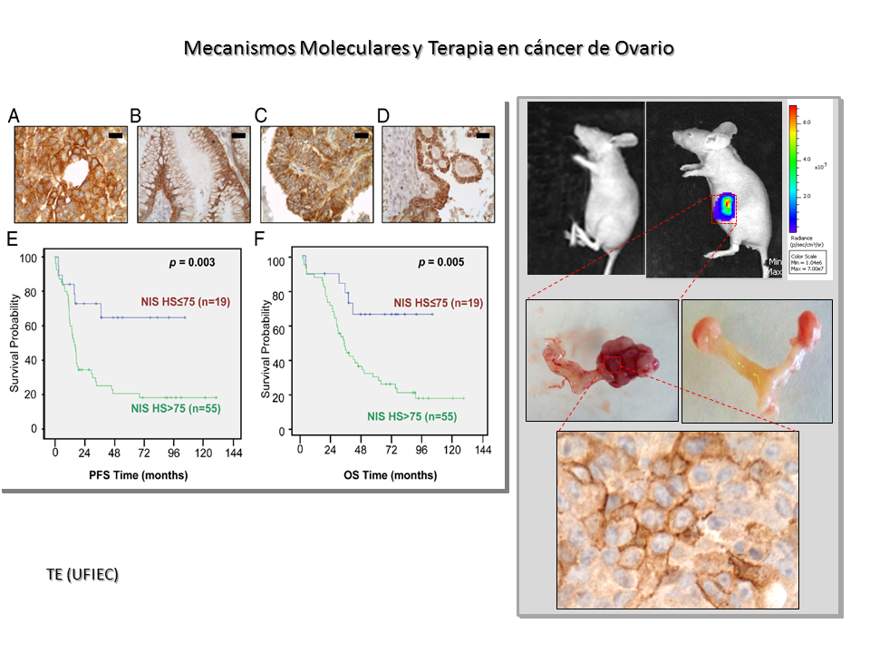 Mecanismos moleculares cancer ovario.png