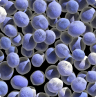 Infecciones bacterianas inmunoprevenibles