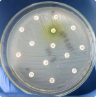 Resistencia a antibióticos e IRAS