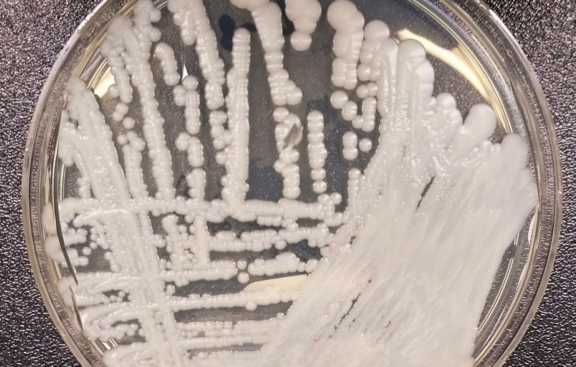 Imagen del hongo C. auris en cultivo.