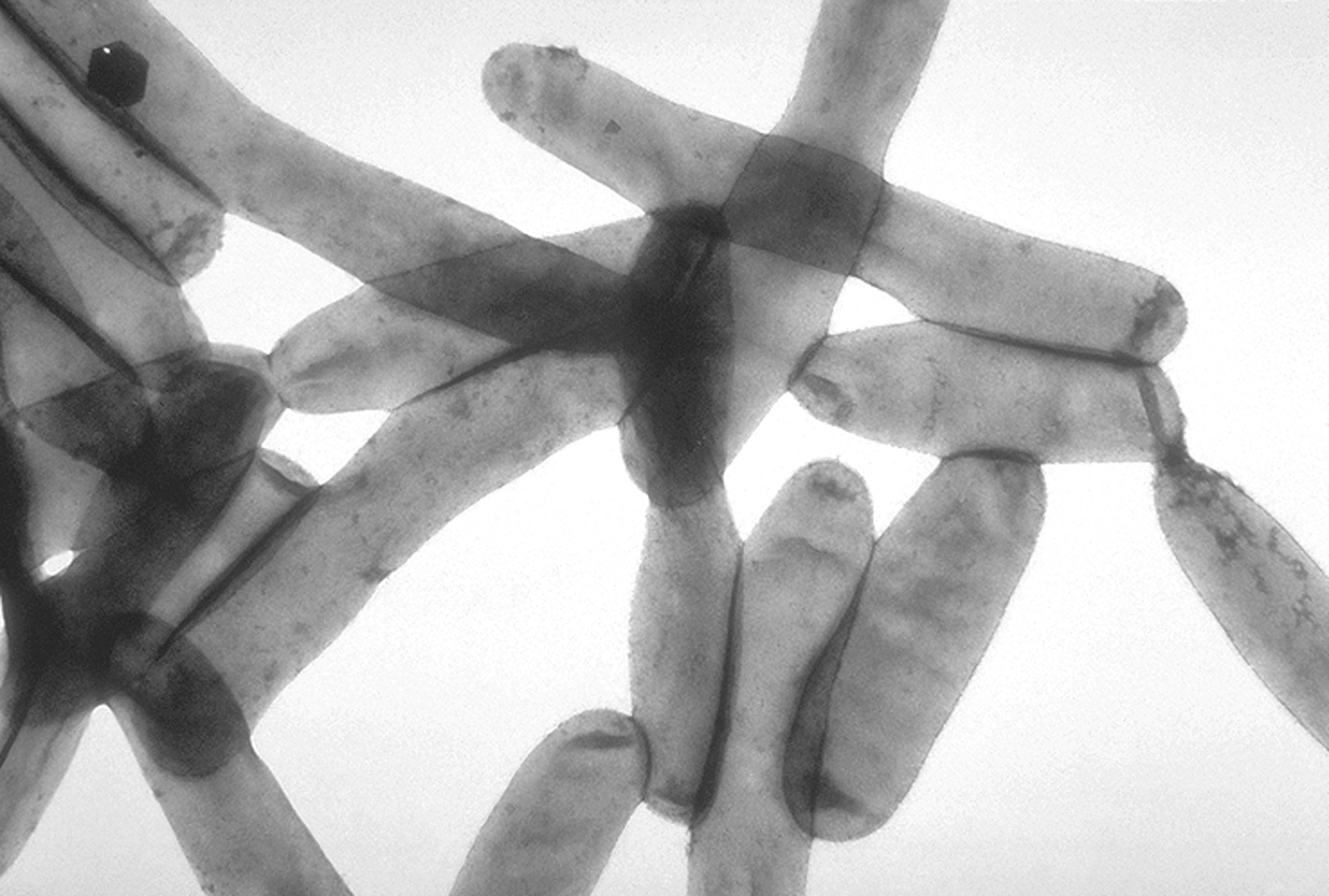Estudio en el noreste de España revela que sistemas de riego agrícola pueden albergar bacteria de la legionelosis