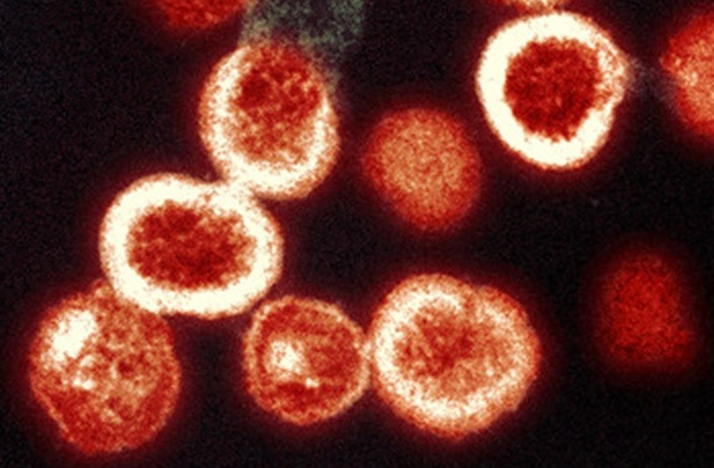 Partículas del virus del VIH (Imagen: NIAID).