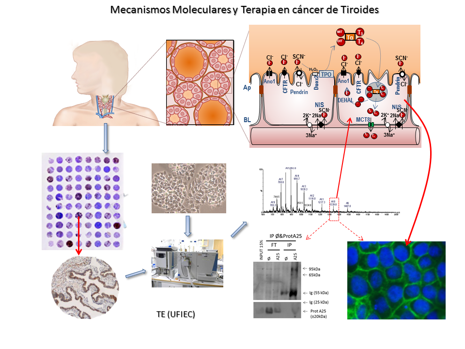 Mecanismos moleculares cancer tiroides.png